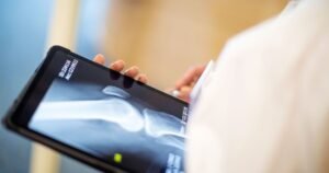 Barra Funda oferece exames gratuitos contra osteoporose